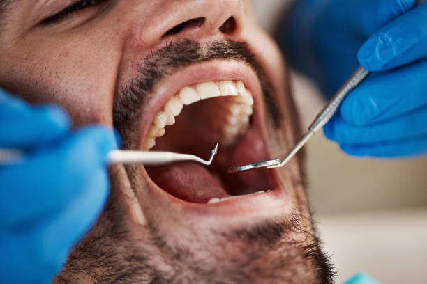 Best Emergency Treatment for Dental Infections or Abscesses in St Charles, MO