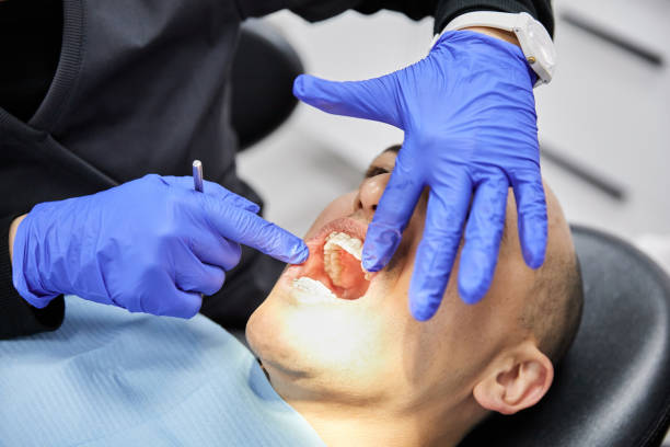 Best Urgent Care for Lost Fillings or Crowns in St Charles, MO